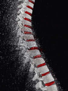 מהי עקמת אידיופטית וכיצד מאבחנים אותה בשלבים מוקדמים: מדריך מקיף